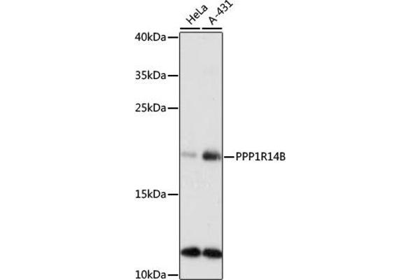 PPP1R14B anticorps  (AA 68-147)