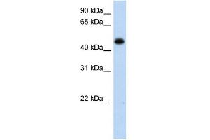 HAO1 antibody used at 1 ug/ml to detect target protein.