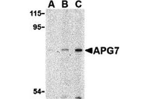 Western Blotting (WB) image for anti-ATG7 Autophagy Related 7 (ATG7) (N-Term) antibody (ABIN1031233) (ATG7 anticorps  (N-Term))