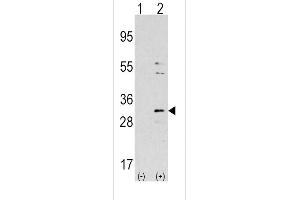 Western blot analysis of NNMT using rabbit polyclonal NNMT Antibody using 293 cell lysates (2 ug/lane) either nontransfected (Lane 1) or transiently transfected with the NNMT gene (Lane 2).