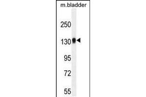 Western blot analysis in mouse bladder tissue lysates (35ug/lane). (TDRD7 anticorps  (C-Term))