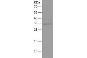 Western Blotting (WB) image for Uridine Phosphorylase 1 (UPP1) (AA 1-310) protein (His-IF2DI Tag) (ABIN7125661)