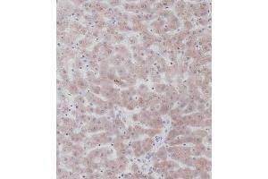 Immunohistochemical analysis of C on paraffin-embedded Human liver tissue. (UGT2B15 anticorps  (AA 156-185))