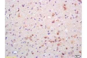 Formalin-fixed and paraffin embedded rat brain labeled with Rabbit Anti Phospho-NMDAR2B (Tyr1336) Polyclonal Antibody, Unconjugated (ABIN801228) at 1:200 followed by conjugation to the secondary antibody and DAB staining (GRIN2B anticorps  (pTyr1336))