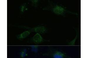 Immunofluorescence analysis of U-251 MG cells using VHL Polyclonal Antibody at dilution of 1:100 (40x lens). (VHL anticorps)