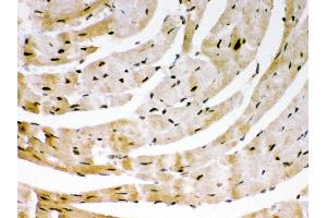 Anti- SIRT6Picoband antibody, IHC(P) IHC(P): Mouse Cardiac Muscle Tissue (SIRT6 anticorps  (AA 14-180))