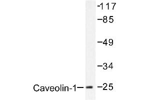 Image no. 1 for anti-Caveolin 1, Caveolae Protein, 22kDa (CAV1) antibody (ABIN265339) (Caveolin-1 anticorps)