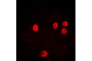 Immunofluorescent analysis of Histone H2B (AcK12) staining in HeLa cells. (Histone H2B anticorps  (acLys12, N-Term))