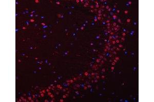 IF analysis of SNRPN using anti-SNRPN antibody (ABIN3043934). (SNRPN anticorps  (N-Term))