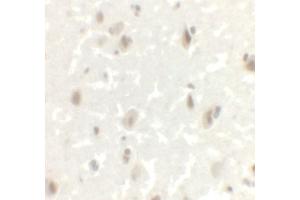 Immunohistochemistry (IHC) image for anti-LIM Homeobox Transcription Factor 1, alpha (LMX1A) (C-Term) antibody (ABIN1077395) (LMX1A anticorps  (C-Term))
