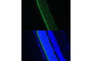 Immunofluorescence analysis of rat eye using GNGT1 Polyclonal Antibody (ABIN7267288) at dilution of 1:100 (40x lens). (GNGT1 anticorps  (AA 1-45))