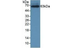 Detection of Recombinant CRHBP, Rat using Monoclonal Antibody to Corticotropin Releasing Hormone Binding Protein (CRHBP)