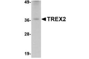Image no. 1 for anti-three Prime Repair Exonuclease 2 (Trex2) (C-Term) antibody (ABIN341719) (TREX2 anticorps  (C-Term))