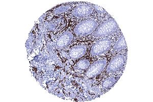 Intense CD56 immunostaining of nerve fibres in the appendix mucosa (Recombinant CD56 anticorps)