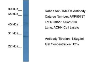 WB Suggested Anti-TMCO4  Antibody Titration: 0. (TMCO4 anticorps  (C-Term))