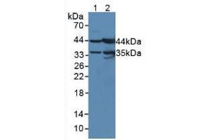Figure. (UPB1 anticorps  (AA 121-384))