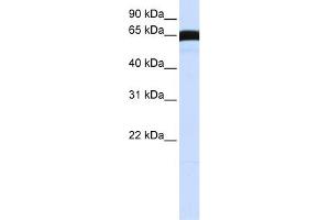 WB Suggested Anti-PLK1 Antibody Titration:  0.