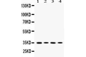 Western blot analysis of MC1 Receptor expression in PC12 whole cell lysates ( Lane 1), HEPA1-6 whole cell lysates ( Lane 2), HELA whole cell lysates ( Lane 3) and A375 whole cell lysates ( Lane 4). (MC1 Receptor anticorps  (C-Term))