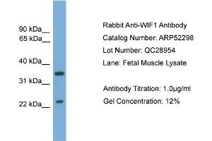 WB Suggested Anti-WIF1  Antibody Titration: 0.