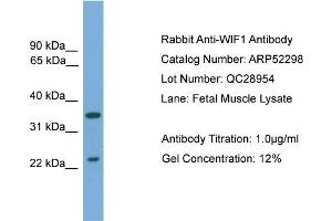 WB Suggested Anti-WIF1  Antibody Titration: 0. (WIF1 anticorps  (N-Term))