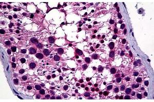 Human Testis: Formalin-Fixed, Paraffin-Embedded (FFPE) (HDAC6 anticorps  (AA 7-56))