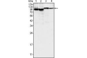 Western blot analysis using BTK mouse mAb against K562 (1), MCF-7 (2), Jurkat (3) and HEK293 (4) cell lysate.