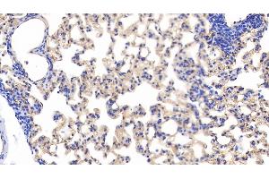 Detection of PODXL in Rat Lung Tissue using Polyclonal Antibody to Podocalyxin (PODXL)