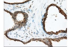 Immunohistochemical staining of paraffin-embedded Human Kidney tissue using anti-ACAT2 mouse monoclonal antibody. (ACAT2 anticorps)