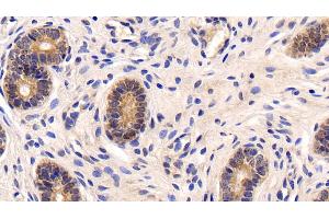 Detection of NFkB in Porcine Uterus Tissue using Polyclonal Antibody to Nuclear Factor Kappa B (NFkB)