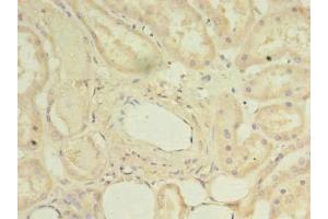 Immunohistochemistry of paraffin-embedded human kidney tissue using ABIN7150796 at dilution of 1:100 (DYRK4 anticorps  (AA 201-520))