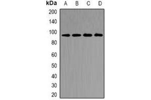 Western blot analysis of CD2AP expression in MCF7 (A), SW480 (B), mouse kidney (C), rat kidney (D) whole cell lysates. (CD2AP anticorps)