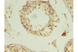 Immunohistochemistry of paraffin-embedded human testis tissue using ABIN7150974 at dilution of 1:100 (RANBP2 anticorps  (AA 2601-2802))