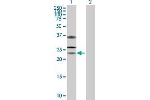 anti-Ubiquitin Specific Peptidase 53 (USP53) (AA 1-188) antibody