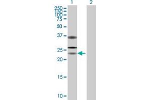 Western Blot analysis of USP53 expression in transfected 293T cell line by USP53 MaxPab polyclonal antibody. (USP53 anticorps  (AA 1-188))