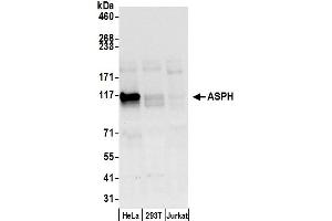 Western Blotting (WB) image for anti-Aspartate beta-Hydroxylase (ASPH) (AA 300-350) antibody (ABIN7449995)
