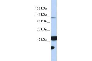 WB Suggested Anti-MLH3 Antibody Titration:  0. (MLH3 anticorps  (Middle Region))