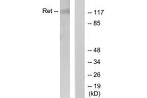 Western blot analysis of extracts from K562 cells, using Ret (Ab-1062) Antibody. (Ret Proto-Oncogene anticorps  (AA 1041-1090))