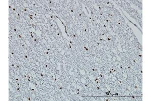 Immunoperoxidase of monoclonal antibody to HIST1H3D on formalin-fixed paraffin-embedded human lateral ventricle wall.