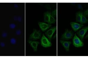 Detection of COL3a1 in Human Hela cell using Polyclonal Antibody to Collagen Type III Alpha 1 (COL3a1)