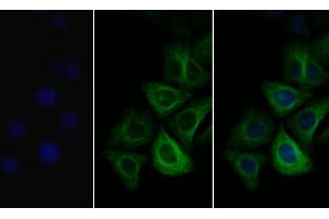 Detection of COL3a1 in Human Hela cell using Polyclonal Antibody to Collagen Type III Alpha 1 (COL3a1) (COL3A1 anticorps  (AA 1171-1435))
