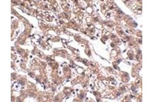 Immunohistochemistry (IHC) image for anti-Metastasis Associated in Colon Cancer 1 (MACC1) (Middle Region) antibody (ABIN1030992)