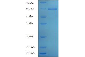 SDS-PAGE (SDS) image for Caspase 2, Apoptosis-Related Cysteine Peptidase (CASP2) (AA 2-452) protein (His-SUMO Tag) (ABIN5709201)