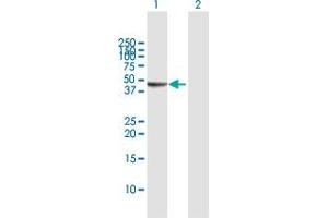 Western Blot analysis of SERPINB3 expression in transfected 293T cell line by SERPINB3 MaxPab polyclonal antibody. (SERPINB3 anticorps  (AA 1-390))