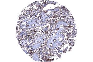 Placenta mature Strong CD141 staining of the surface cell layer of the cytotrophoblast and of endothelial cells CD141 immunohistochemistry. (Recombinant Thrombomodulin anticorps  (AA 69-194))