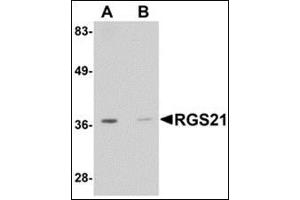 Western blot analysis: AP30716PU-N RGS21 antibody staining of HepG2 cell lysate at 0. (RGS21 anticorps  (Center))