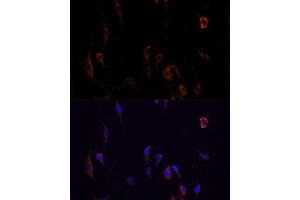 Immunofluorescence analysis of PC12 cells using OCLN antibody. (Occludin anticorps  (AA 263-522))