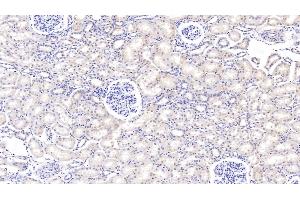 Detection of PIGR in Bovine Kidney Tissue using Polyclonal Antibody to Polymeric Immunoglobulin Receptor (PIGR)