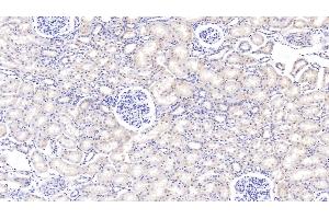 Detection of PIGR in Bovine Kidney Tissue using Polyclonal Antibody to Polymeric Immunoglobulin Receptor (PIGR) (PIGR anticorps  (AA 461-560))