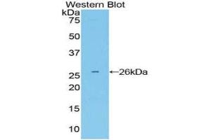 Western Blotting (WB) image for anti-Growth Factor Receptor-Bound Protein 7 (GRB7) (AA 298-489) antibody (ABIN1859066) (GRB7 anticorps  (AA 298-489))