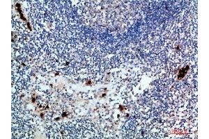 Immunohistochemical analysis of paraffin-embedded human-lymph, antibody was diluted at 1:200 (ZAP7 (AA 391-440) anticorps)